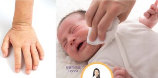 潮濕天氣、濕疹救星到